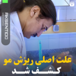 علت اصلی ریزش مو کشف شد