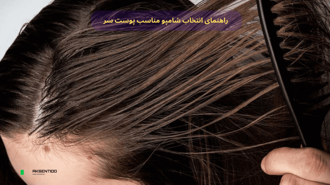 راهنمای انتخاب شامپو مناسب پوست سر